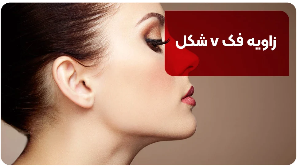 زاویه فک v شکل