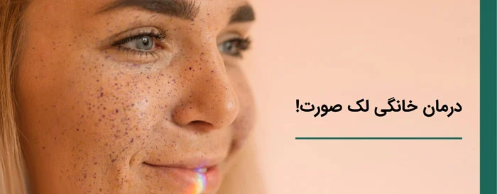 روش های خانگی از بین بردن لک صورت